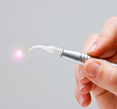 Laser Dentistry Near Me in Oxnard, CA