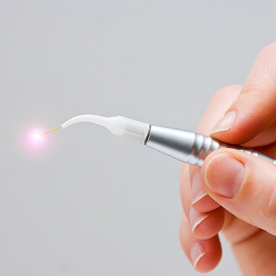Laser Dentistry Near Me in Oxnard, CA