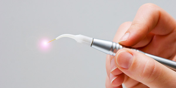 Laser Dentistry Services Near Me in Oxnard CA Laser Dentistry Services Near Me in Oxnard CA