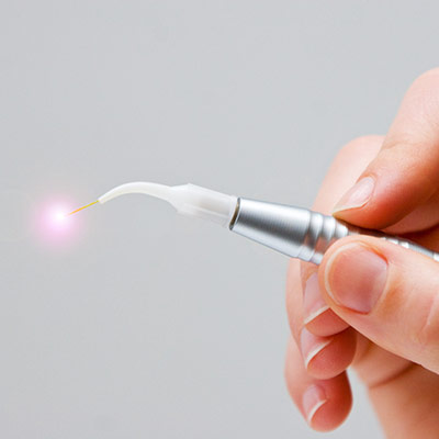 Laser Dentistry Near Me in Oxnard, CA