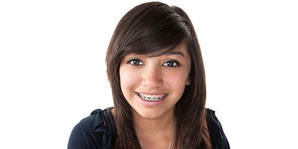 Orthodontic Braces Near Me in Oxnard CA Orthodontic Braces Near Me in Oxnard CA